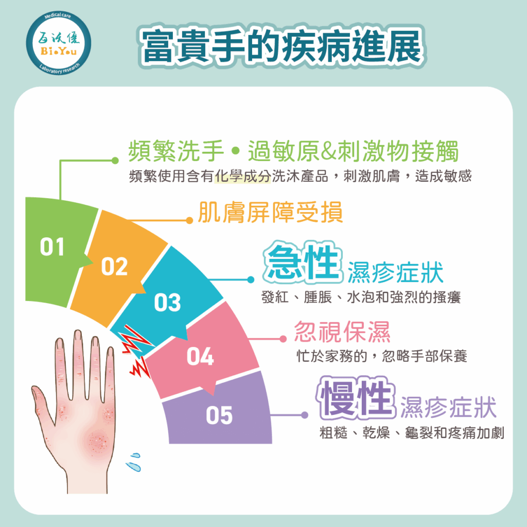 富貴手的疾病進程