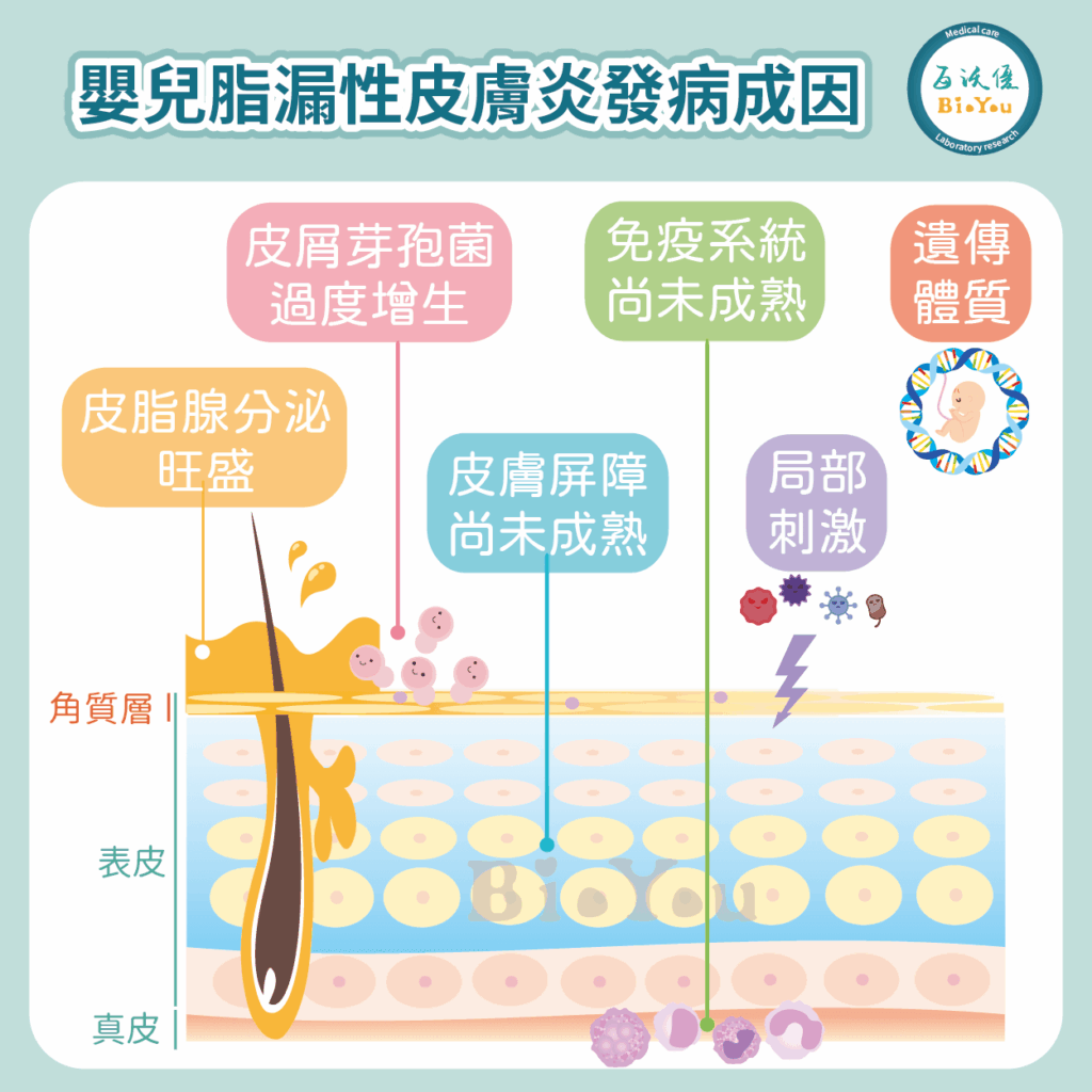 嬰兒脂漏性皮膚炎發病成因