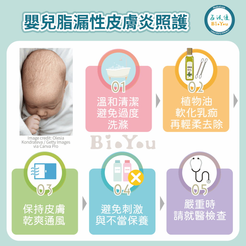 嬰兒脂漏性皮膚炎的照護方式