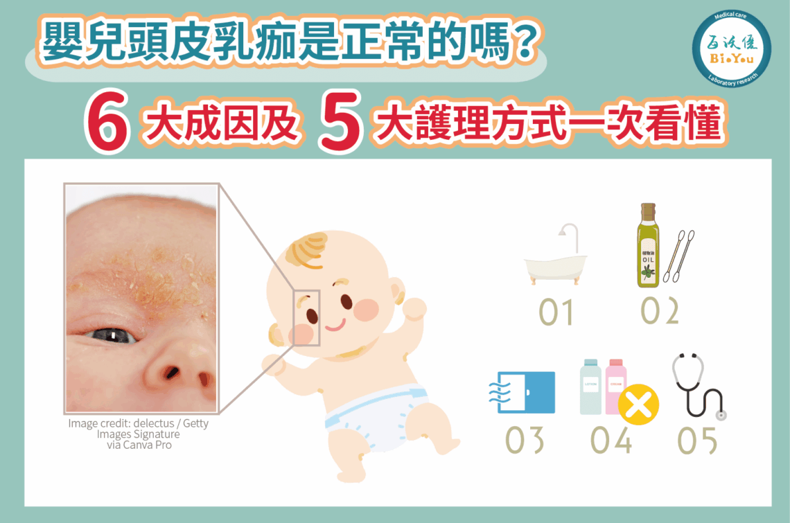 嬰兒頭皮乳痂是正常的嗎?【嬰兒脂漏性皮膚炎】的6大成因及5大護理方式一次看懂
