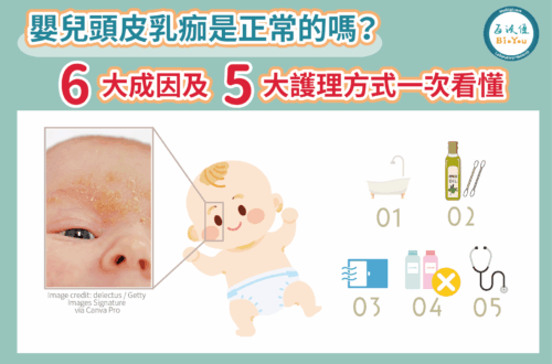 嬰兒頭皮乳痂是正常的嗎？【嬰兒脂漏性皮膚炎】的6大成因及5大護理方式一次看懂