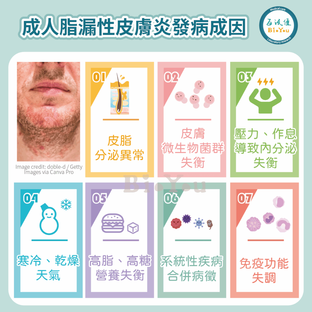 脂漏性皮膚炎的發病成因