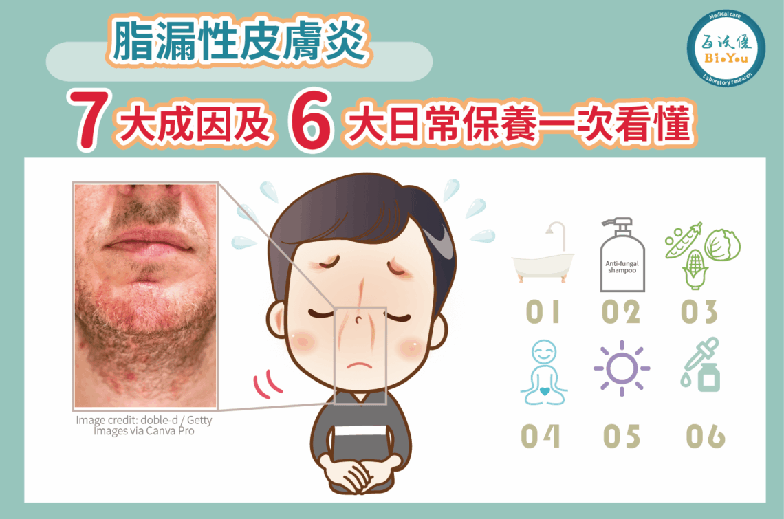 脂漏性皮膚炎的7大成因及6大照護方法