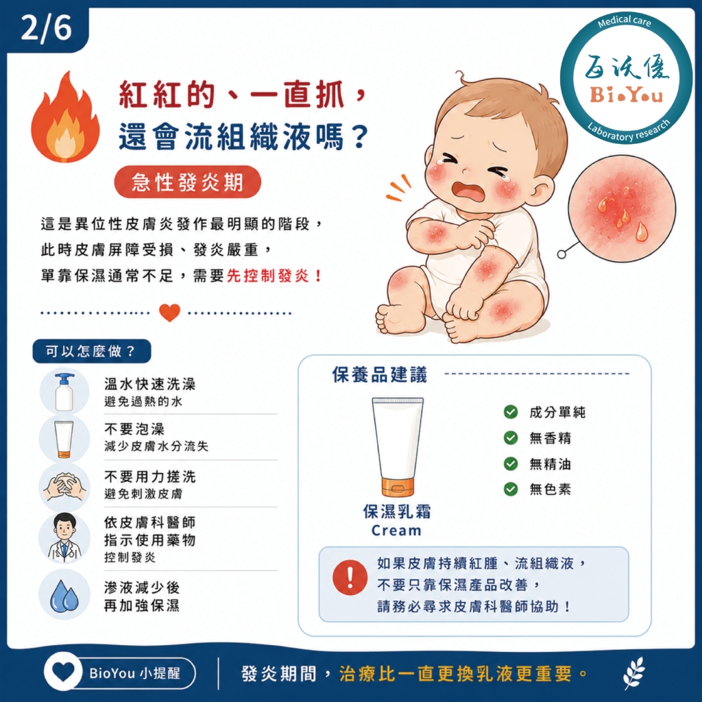 異位性皮膚炎急性期的照護方式